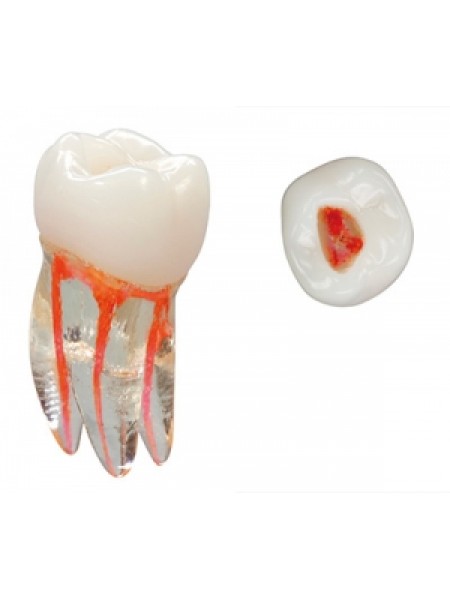 Эндо Трейнер Зуб (Endo Training tooth) (НДС 18%)